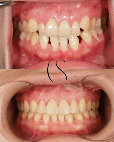 STOMO Clinic Dentysta | Stomatolog | Ortodonta | Implanty zębów | Bonding | Licówki | Protezy Na Implantach